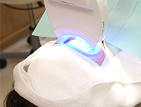 オフィスホワイトニング（医院で行う）