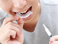 ホームホワイトニング