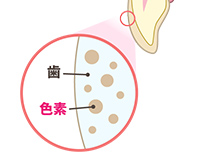 ホワイトニングのメカニズム ①