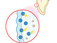 ホワイトニングのメカニズム ②
