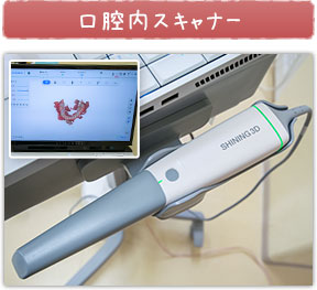 口腔内スキャナー